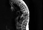 Updated Guideline for Palliative Radiotherapy for Bone Metastases Updated Guideline for Palliative Radiotherapy for Bone Metastases