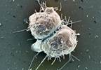Stem Cell Therapies for Degenerative Disc Disease Stem Cell Therapies for Degenerative Disc Disease