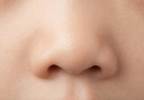 Nasal Nerve Block for Migraine Relief in Children Nasal Nerve Block for Migraine Relief in Children