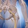 Pregabalin for Sciatica: Is It Effective? Pregabalin for Sciatica: Is It Effective?