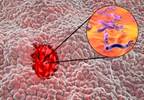 Patients With Fibromyalgia Syndrome Might Have Increased Risk for Peptic Ulcer Disease Patients With Fibromyalgia Syndrome Might Have Increased Risk for Peptic Ulcer Disease