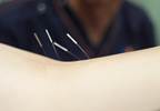Comparing Dry Needling, Cortisone for Greater Trochanteric Pain Syndrome Comparing Dry Needling, Cortisone for Greater Trochanteric Pain Syndrome