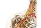 Levobupivacaine vs Ropivacaine for Brachial Plexus Block Levobupivacaine vs Ropivacaine for Brachial Plexus Block