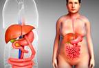 A Fifth of Bariatric Surgery Patients Using Opioids 7 Years Later A Fifth of Bariatric Surgery Patients Using Opioids 7 Years Later