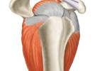 Ultrasonography-Guided Percutaneous Irrigation for Calcific Tendinopathy: 1 vs 2 Needles Ultrasonography-Guided Percutaneous Irrigation for Calcific Tendinopathy: 1 vs 2 Needles