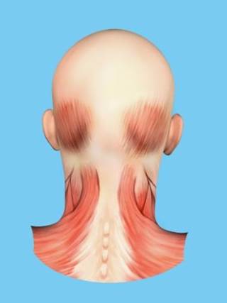 An earlier study showed that corrugator supercilia muscle resection led to improvement in symptoms for 80% of patients with migraine headaches. An earlier study showed that corrugator supercilia muscle resection led to improvement in symptoms for 80% of patients with migraine headaches.