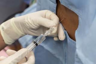 This study may “have mirrored central neuroinflammation in this very debilitating chronic pain condition.” This study may “have mirrored central neuroinflammation in this very debilitating chronic pain condition.”