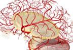 Finding the Link Between Migraine and Cerebral Blood Flow Finding the Link Between Migraine and Cerebral Blood Flow