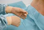 Uniport vs Multiport Catheters for Labor Epidural Analgesia Uniport vs Multiport Catheters for Labor Epidural Analgesia