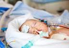 Neuraxial Analgesia in Neonates: Overview and Expert Q&A Neuraxial Analgesia in Neonates: Overview and Expert Q&A