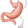 Device-Specific ICD Codes Needed According to Researchers Device-Specific ICD Codes Needed According to Researchers