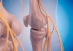 Is Nerve Decompression Effective for Restless Leg Syndrome? Is Nerve Decompression Effective for Restless Leg Syndrome?