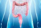 Colon Cleansing Regimens in Inflammatory Bowel Disease: An Overview Colon Cleansing Regimens in Inflammatory Bowel Disease: An Overview