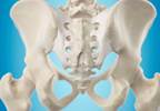 Fluoroscopically Guided Sacroiliac Interventions: Appropriate Use Criteria Fluoroscopically Guided Sacroiliac Interventions: Appropriate Use Criteria