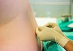 Epidural Analgesia May Reduce Short-Term Mortality in Acute Pancreatitis Epidural Analgesia May Reduce Short-Term Mortality in Acute Pancreatitis