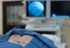 Conventional Radiofrequency Ablation More Effective Than Pulsed Radiofrequency for Perineal Pain Conventional Radiofrequency Ablation More Effective Than Pulsed Radiofrequency for Perineal Pain