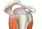 Injections of Corticosteroids vs Local Anesthetic in Rotator Cuff-Related Shoulder Pain Injections of Corticosteroids vs Local Anesthetic in Rotator Cuff-Related Shoulder Pain