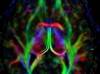 Case Study: Amnestic Syndrome After Combined Cocaine, Fentanyl Use Case Study: Amnestic Syndrome After Combined Cocaine, Fentanyl Use