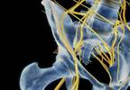 Radiofrequency Ablation for Chronic Hip Pain in Osteoarthritis: Reviewing the Evidence Radiofrequency Ablation for Chronic Hip Pain in Osteoarthritis: Reviewing the Evidence