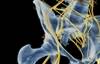Radiofrequency Ablation for Chronic Hip Pain in Osteoarthritis: Reviewing the Evidence Radiofrequency Ablation for Chronic Hip Pain in Osteoarthritis: Reviewing the Evidence