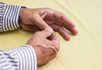 Corticosteroids May Be an Effective Alternative to NSAIDs in Acute Gout Pain Corticosteroids May Be an Effective Alternative to NSAIDs in Acute Gout Pain