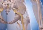 Various Factors Affect Progress in Back-Related Leg Pain, Sciatica Various Factors Affect Progress in Back-Related Leg Pain, Sciatica