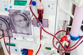 The investigators used the US Renal Data System to evaluate adverse events in 140,899 Medicare beneficiaries who received hemodialysis in 2011. The investigators used the US Renal Data System to evaluate adverse events in 140,899 Medicare beneficiaries who received hemodialysis in 2011.