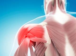 Investigators enrolled 189 patients with chronic musculoskeletal pain on long-term opioid therapy and reporting severe pain intensity. Investigators enrolled 189 patients with chronic musculoskeletal pain on long-term opioid therapy and reporting severe pain intensity.