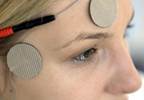 Transcutaneous Electrical Nerve Stimulation May Be Effective for Migraine Transcutaneous Electrical Nerve Stimulation May Be Effective for Migraine