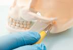 Biopsychosocial Factors May Help With Coping in Chronic Temporomandibular Disorder Biopsychosocial Factors May Help With Coping in Chronic Temporomandibular Disorder