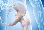 Hip Injury and "Giving Way" Associated With Pain Exacerbation in Hip Osteoarthritis Hip Injury and "Giving Way" Associated With Pain Exacerbation in Hip Osteoarthritis
