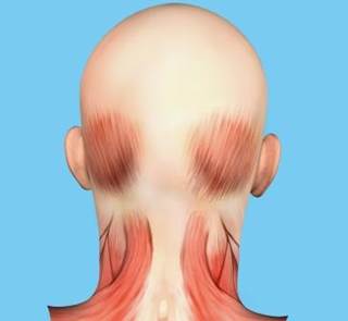 Myofascial trigger points are thought to play a role in the pathophysiology of pain conditions, including headache disorders. Myofascial trigger points are thought to play a role in the pathophysiology of pain conditions, including headache disorders.