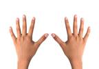 Lower Weighting of Hand Cortical Representations in CRPS Lower Weighting of Hand Cortical Representations in CRPS
