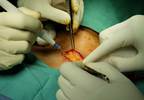 Patients Undergoing Thyroid Surgery May Require Few Opioids Patients Undergoing Thyroid Surgery May Require Few Opioids