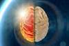 Hemicrania Continua: Diagnosis and Treatment Hemicrania Continua: Diagnosis and Treatment